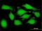 Proteasome 26S Subunit, Non-ATPase 9 antibody, H00005715-B01P, Novus Biologicals, Immunocytochemistry image 