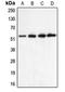 Cholinergic Receptor Nicotinic Alpha 5 Subunit antibody, LS-C352000, Lifespan Biosciences, Western Blot image 