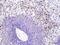 Elastase, Neutrophil Expressed antibody, ab68672, Abcam, Immunohistochemistry paraffin image 