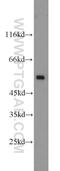 Desmin antibody, 16520-1-AP, Proteintech Group, Western Blot image 