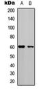 Cell Division Cycle 25C antibody, orb304716, Biorbyt, Western Blot image 