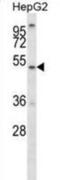 Asparagine-linked glycosylation protein 11 homolog antibody, abx028386, Abbexa, Western Blot image 