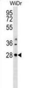 THAP Domain Containing 10 antibody, abx030204, Abbexa, Western Blot image 