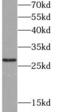 Ubiquitin C-Terminal Hydrolase L3 antibody, FNab09219, FineTest, Western Blot image 