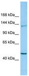 Cytoplasmic Linker Associated Protein 2 antibody, TA338281, Origene, Western Blot image 