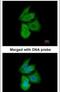 Phosphofructokinase, Liver Type antibody, PA5-21685, Invitrogen Antibodies, Immunofluorescence image 