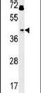 Pyruvate Dehydrogenase E1 Alpha 1 Subunit antibody, PA5-25466, Invitrogen Antibodies, Western Blot image 