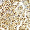 Staphylococcal Nuclease And Tudor Domain Containing 1 antibody, LS-C748465, Lifespan Biosciences, Immunohistochemistry frozen image 