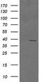 Mitogen-Activated Protein Kinase Kinase 3 antibody, TA505671AM, Origene, Western Blot image 