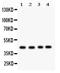 Tumor Susceptibility 101 antibody, RP1078, Boster Biological Technology, Western Blot image 
