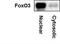 Forkhead Box O3 antibody, NBP2-16521, Novus Biologicals, Western Blot image 