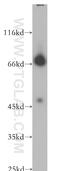 Neuroligin 4 Y-Linked antibody, 13489-1-AP, Proteintech Group, Western Blot image 
