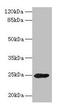 Growth Hormone 2 antibody, CSB-PA009408LA01HU, Cusabio, Western Blot image 