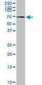 Choline Dehydrogenase antibody, MBS6006905, MyBioSource, Western Blot image 