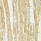 Translocase Of Outer Mitochondrial Membrane 20 antibody, 16-790, ProSci, Immunohistochemistry paraffin image 