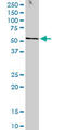 Serine/Threonine Kinase 38 antibody, LS-C133690, Lifespan Biosciences, Western Blot image 