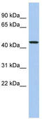 Programmed Cell Death 7 antibody, TA344206, Origene, Western Blot image 