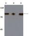 Component Of Inhibitor Of Nuclear Factor Kappa B Kinase Complex antibody, PA5-36652, Invitrogen Antibodies, Western Blot image 