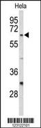Cell Division Cycle 20 antibody, MBS9210218, MyBioSource, Western Blot image 