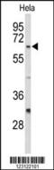 Cell Division Cycle 20 antibody, MBS9210218, MyBioSource, Western Blot image 