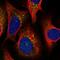 Diphosphoinositol Pentakisphosphate Kinase 2 antibody, NBP2-38368, Novus Biologicals, Immunocytochemistry image 