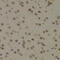 Pro-Apoptotic WT1 Regulator antibody, 18-925, ProSci, Immunohistochemistry paraffin image 