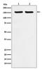 Rho Associated Coiled-Coil Containing Protein Kinase 2 antibody, M01023, Boster Biological Technology, Western Blot image 