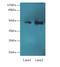 Abhydrolase Domain Containing 2 antibody, LS-C375101, Lifespan Biosciences, Western Blot image 