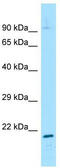 General Transcription Factor IIH Subunit 2 antibody, TA339674, Origene, Western Blot image 