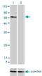 Sorting Nexin 1 antibody, H00006642-M01, Novus Biologicals, Western Blot image 