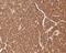 Mucolipin 3 antibody, NBP2-80438, Novus Biologicals, Immunohistochemistry paraffin image 