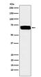 PVR Cell Adhesion Molecule antibody, M00664, Boster Biological Technology, Western Blot image 