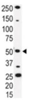 Interleukin 1 Receptor Associated Kinase 4 antibody, ADI-905-693-100, Enzo Life Sciences, Western Blot image 