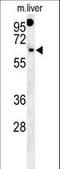 Rhotekin 2 antibody, LS-C162801, Lifespan Biosciences, Western Blot image 