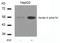 Keratin 8 antibody, GTX50320, GeneTex, Western Blot image 