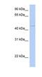 Cytohesin 4 antibody, NBP1-56913, Novus Biologicals, Western Blot image 