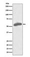 G6PD antibody, M00287, Boster Biological Technology, Western Blot image 