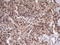 Scm Polycomb Group Protein Homolog 1 antibody, LS-C340509, Lifespan Biosciences, Immunohistochemistry paraffin image 