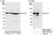 Chaperonin Containing TCP1 Subunit 3 antibody, NBP1-79041, Novus Biologicals, Western Blot image 