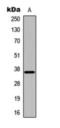 Docking Protein 5 antibody, orb393268, Biorbyt, Western Blot image 