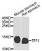 Trefoil Factor 1 antibody, LS-C335183, Lifespan Biosciences, Western Blot image 