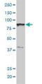 Non-SMC Condensin I Complex Subunit H antibody, H00023397-M01, Novus Biologicals, Western Blot image 