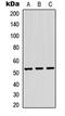 TRNA Methyltransferase 11 Homolog antibody, LS-C354491, Lifespan Biosciences, Western Blot image 