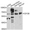 Chromodomain Y-Linked 2B antibody, STJ114536, St John