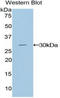 GLI Family Zinc Finger 3 antibody, LS-C294189, Lifespan Biosciences, Western Blot image 