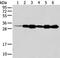 Nudix Hydrolase 22 antibody, PA5-51214, Invitrogen Antibodies, Western Blot image 
