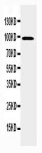 Potassium Voltage-Gated Channel Subfamily Q Member 2 antibody, PA2299, Boster Biological Technology, Western Blot image 