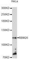 RNA Binding Motif Protein 26 antibody, A13119, ABclonal Technology, Western Blot image 