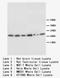 Sodium Voltage-Gated Channel Beta Subunit 1 antibody, orb221094, Biorbyt, Western Blot image 