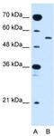 Solute Carrier Family 2 Member 10 antibody, TA333643, Origene, Western Blot image 